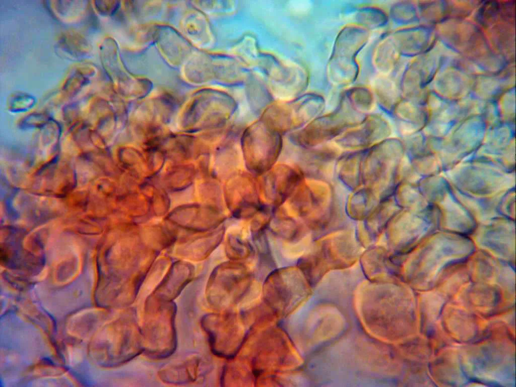 Microscopía de Lycoperdon lividum - 10 - Peridio celulósico 2